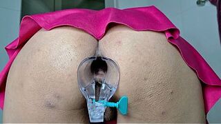 alluring MILF Gape Anal Speculum Closeup